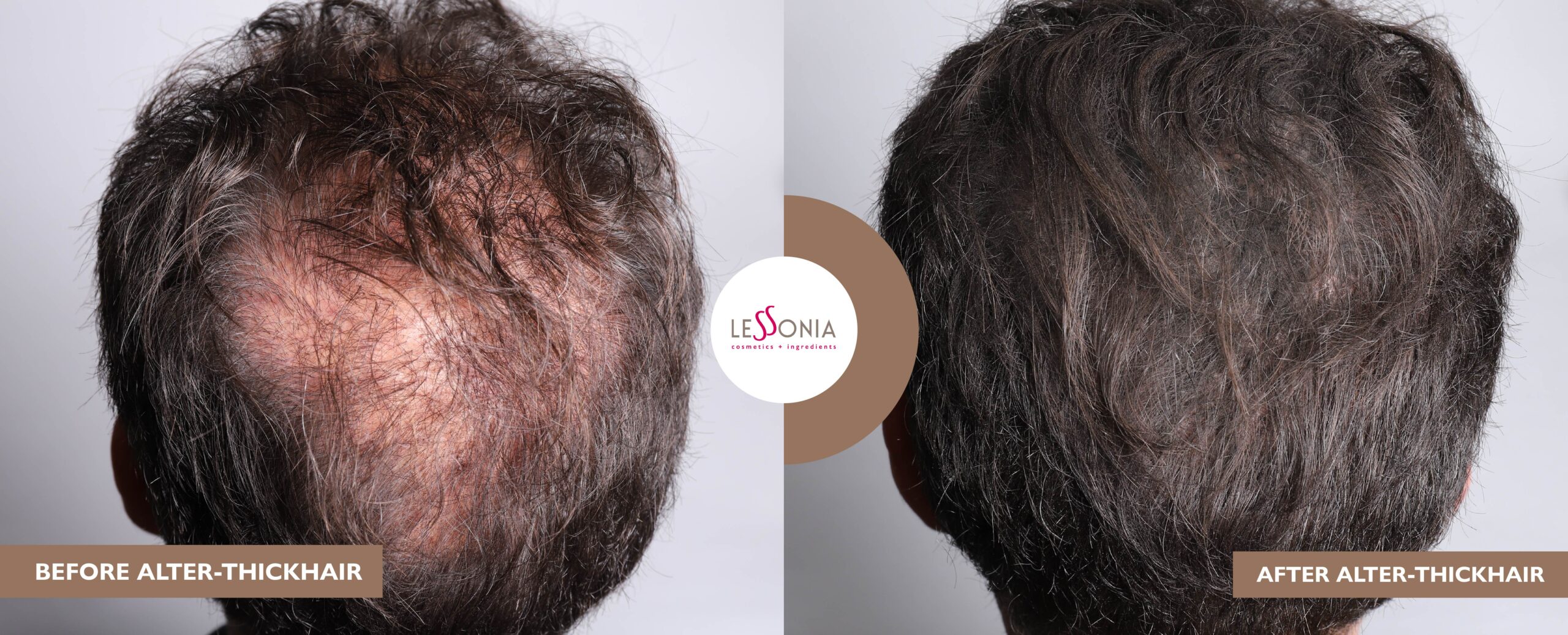 ALTER-THICKHAIR – Densifiant capillaire au bois de Oud ALTER-THICKHAIR – Densifiant capillaire au bois de Oud. Alter-Thickhair est un densifiant capillaire issu de la fibre de bois de Oud. 100% naturel, végétal et upcyclé. Il est l'alternative idéale aux fibres de nylon, de coton ou de kératine.