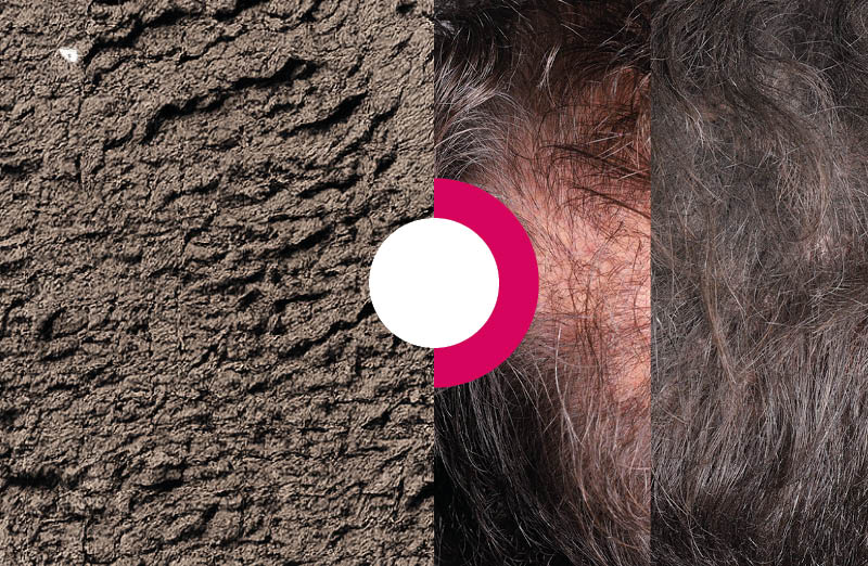 ALTER-THICKHAIR natural Oud wood fibers designed to visibly build hair density and conceal thinning areas.
